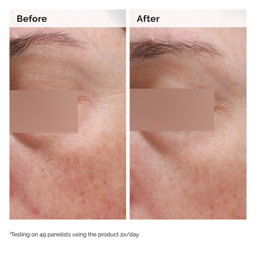niacinamide-5-face-and-body-emulsion-n6 2024-08-23-ORD-Nia-5pct-Face-Body-B-A-Elasticity-Global-02-1x1.jpg