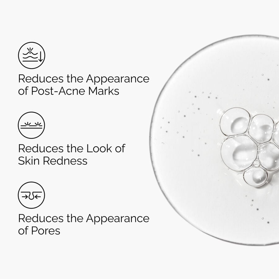 aloe-2-nag-2-solution-r1 FY25-D41247-ORD-Web-PDP-Aloe-Nag-1x1-EN-3a.jpg
