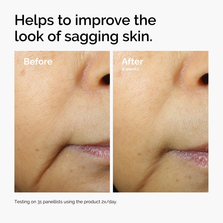 caffeine-3-escin-1-face-serum-m7 ord-caffeine-3pct-escin-1pct-face-serum-before-after-sagging.jpg