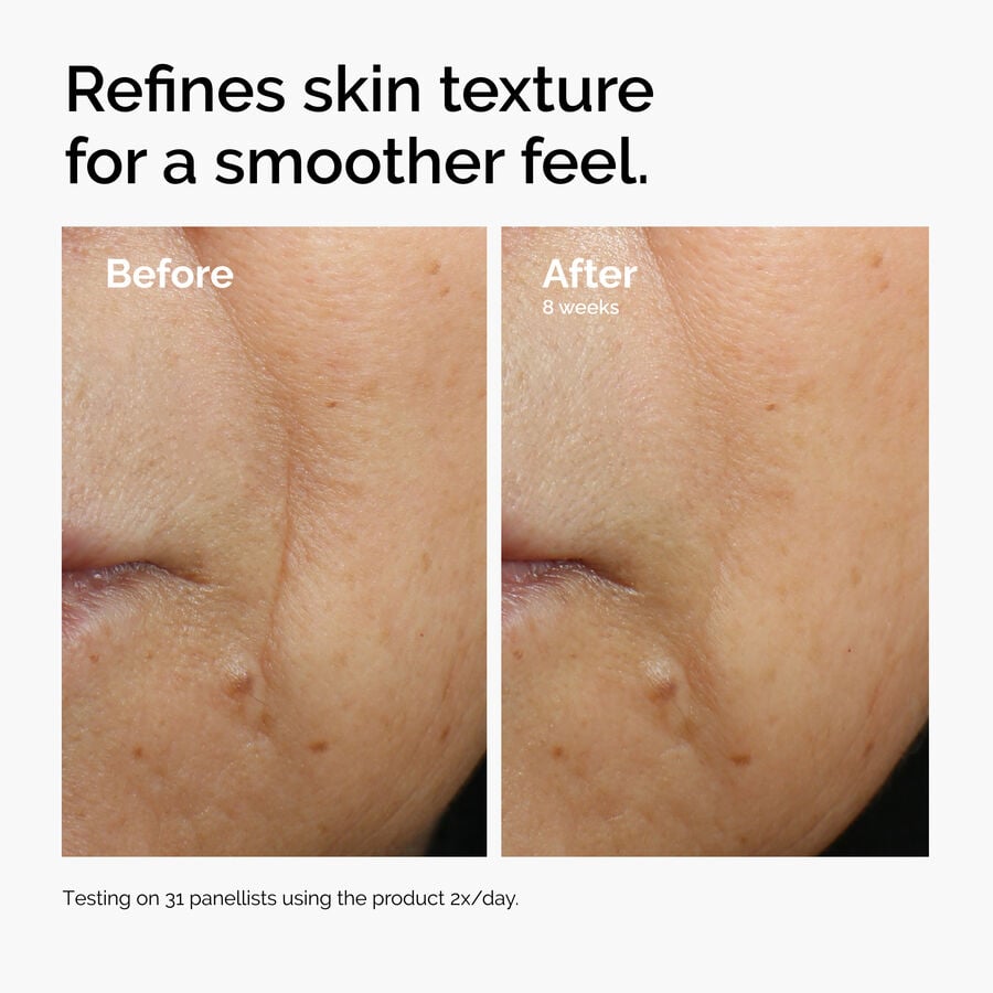 caffeine-3-escin-1-face-serum-m7 ord-caffeine-3pct-escin-1pct-face-serum-before-after-texture.jpg