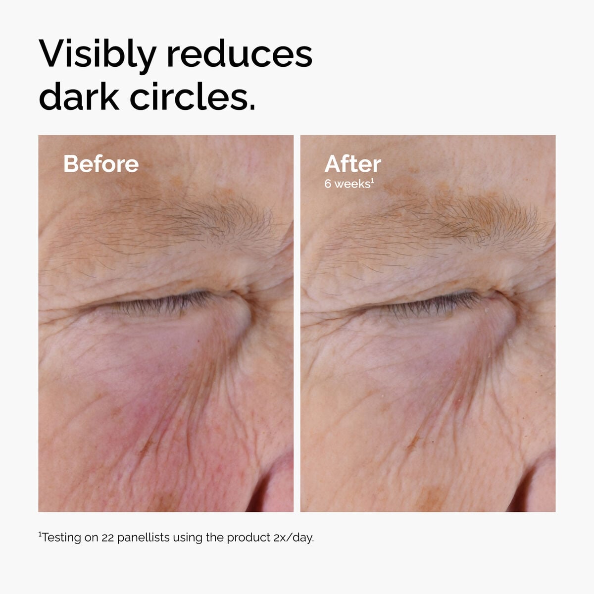 caffeine-solution-5-egcg-eye-serum-j2 ord-caffeine-solution-egcg-dark-circles-before-after.jpg