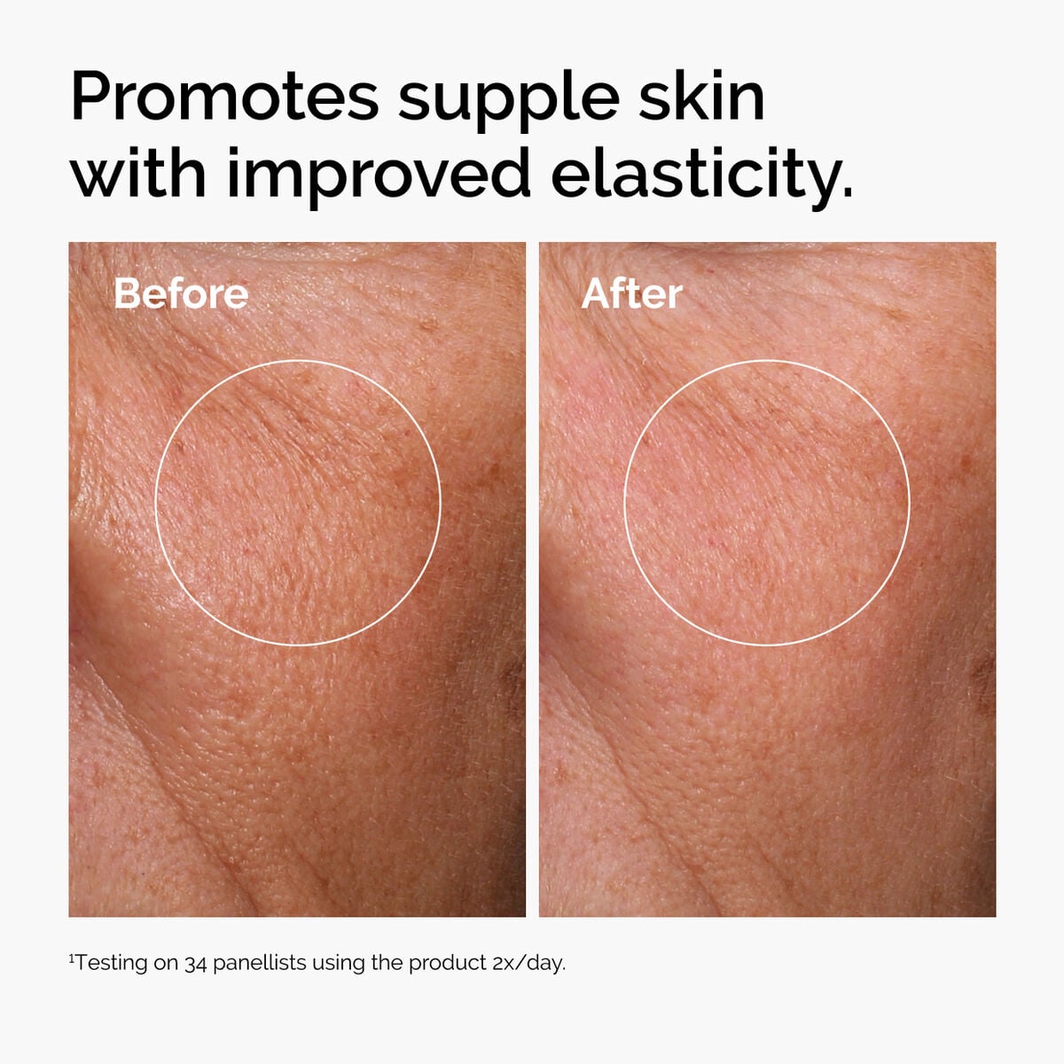 hyaluronic-acid-2-b5-with-ceramides-y5 ord-hyaluronic-acid-2pct-b5-hydrating-serum-before-after-elasticity.jpg