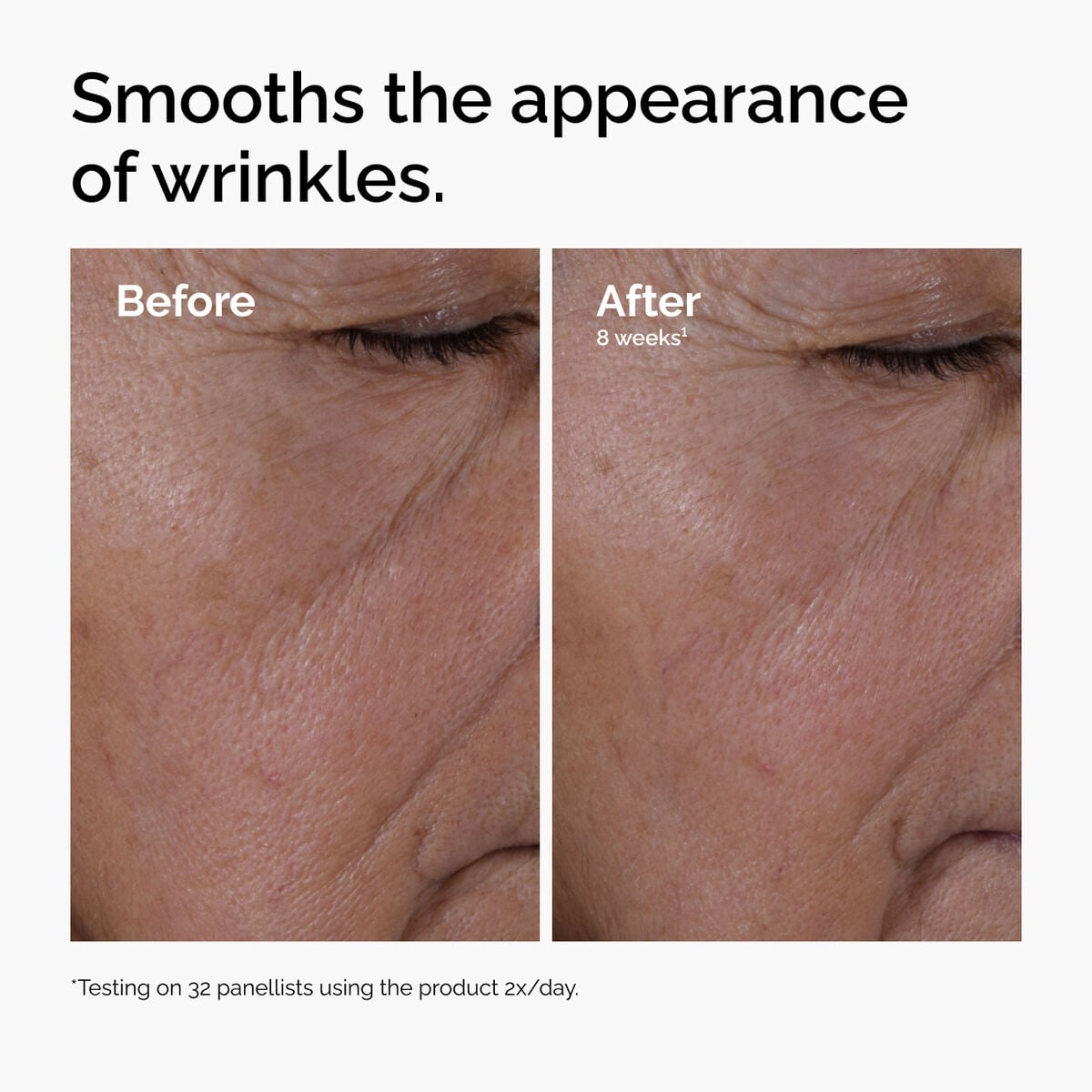 multi-peptide-ha-serum-y6 ord-multi-peptide-ha-serum-wrinkles-before-after.jpg