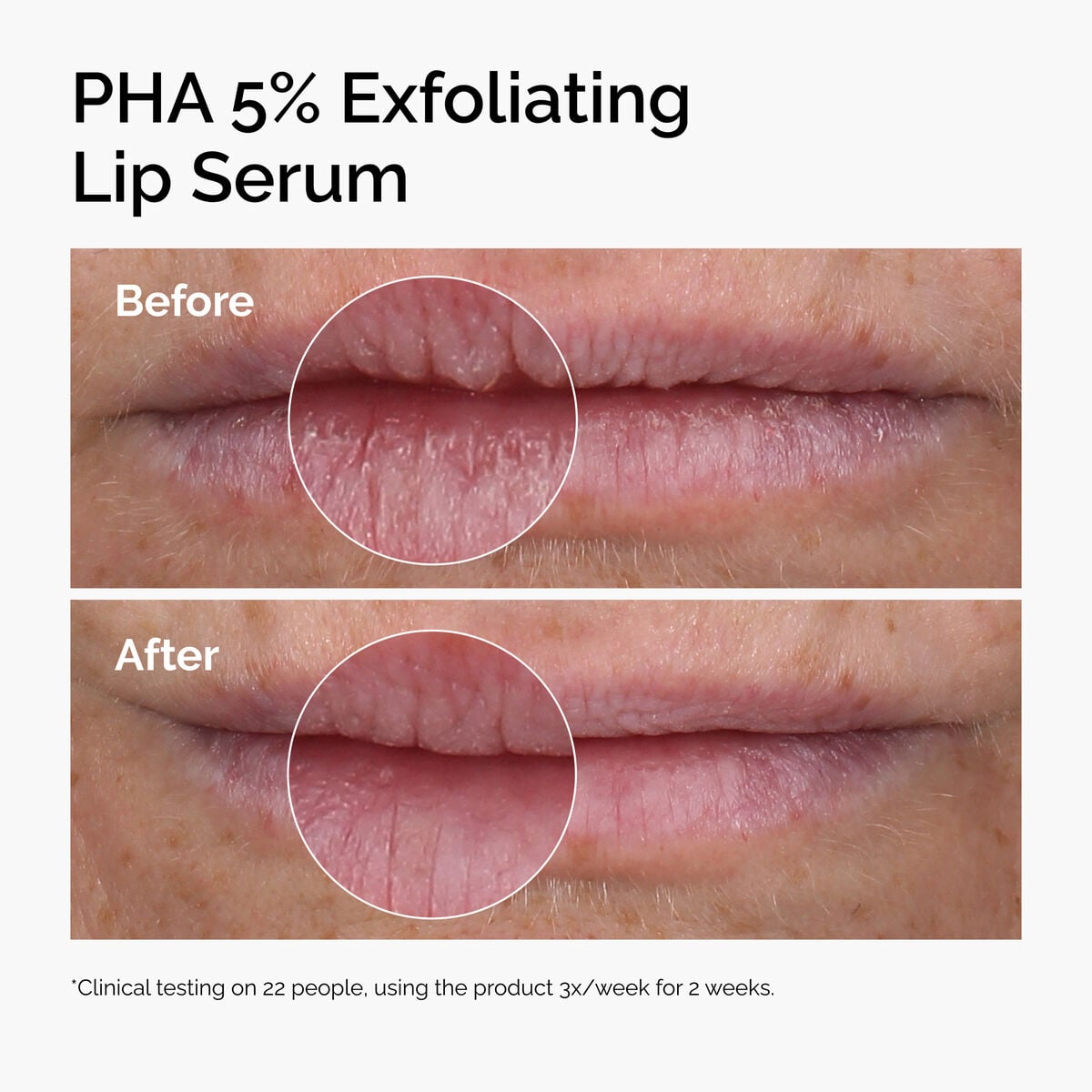 pha-5-exfoliating-lip-serum-t3 ord-pha-5pct-lip-exfoliating-serum-before-after.jpg