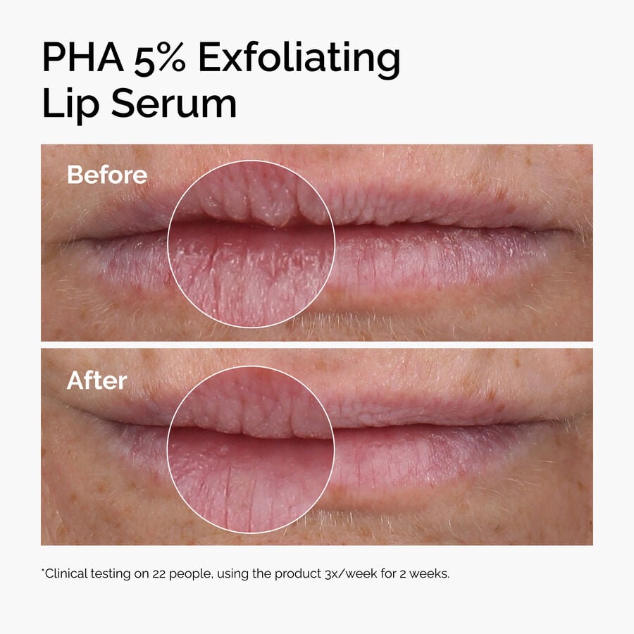 pha-5-exfoliating-lip-serum-t3 ord-pha-5pct-lip-exfoliating-serum-before-after.jpg
