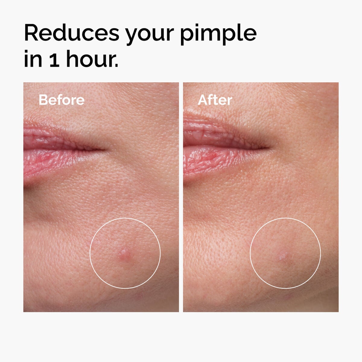 sulfur-10-powder-to-cream-concentrate-f2 ord-sulfur-10pct-powder-to-cream-concentrate-before-after-NA.jpg